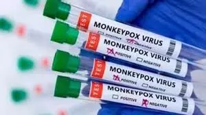 monkeypox virus